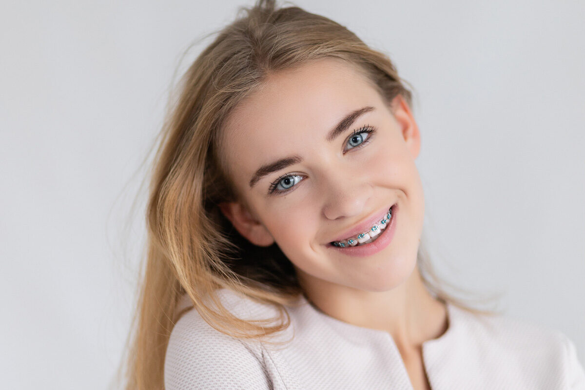 Braces Without Extractionst